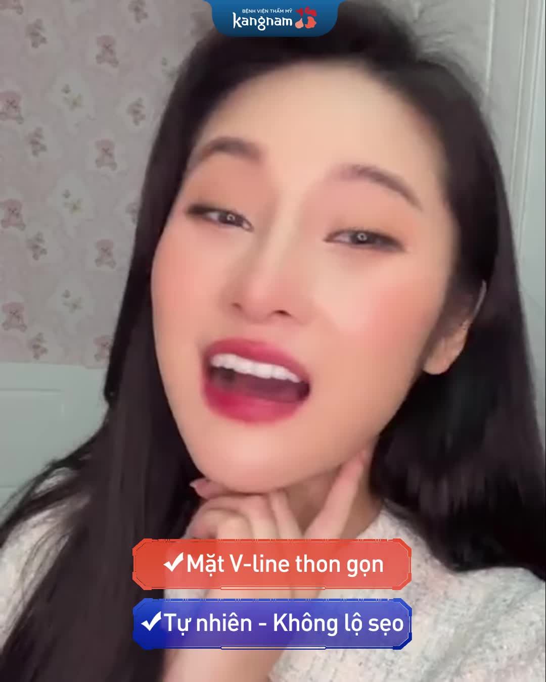 "Hàm vuông, mặt góc cạnh là điều khiến mình tự ti nhất"